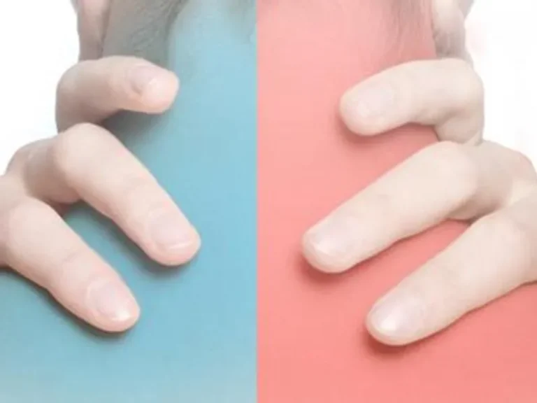 ice heat relieves pain